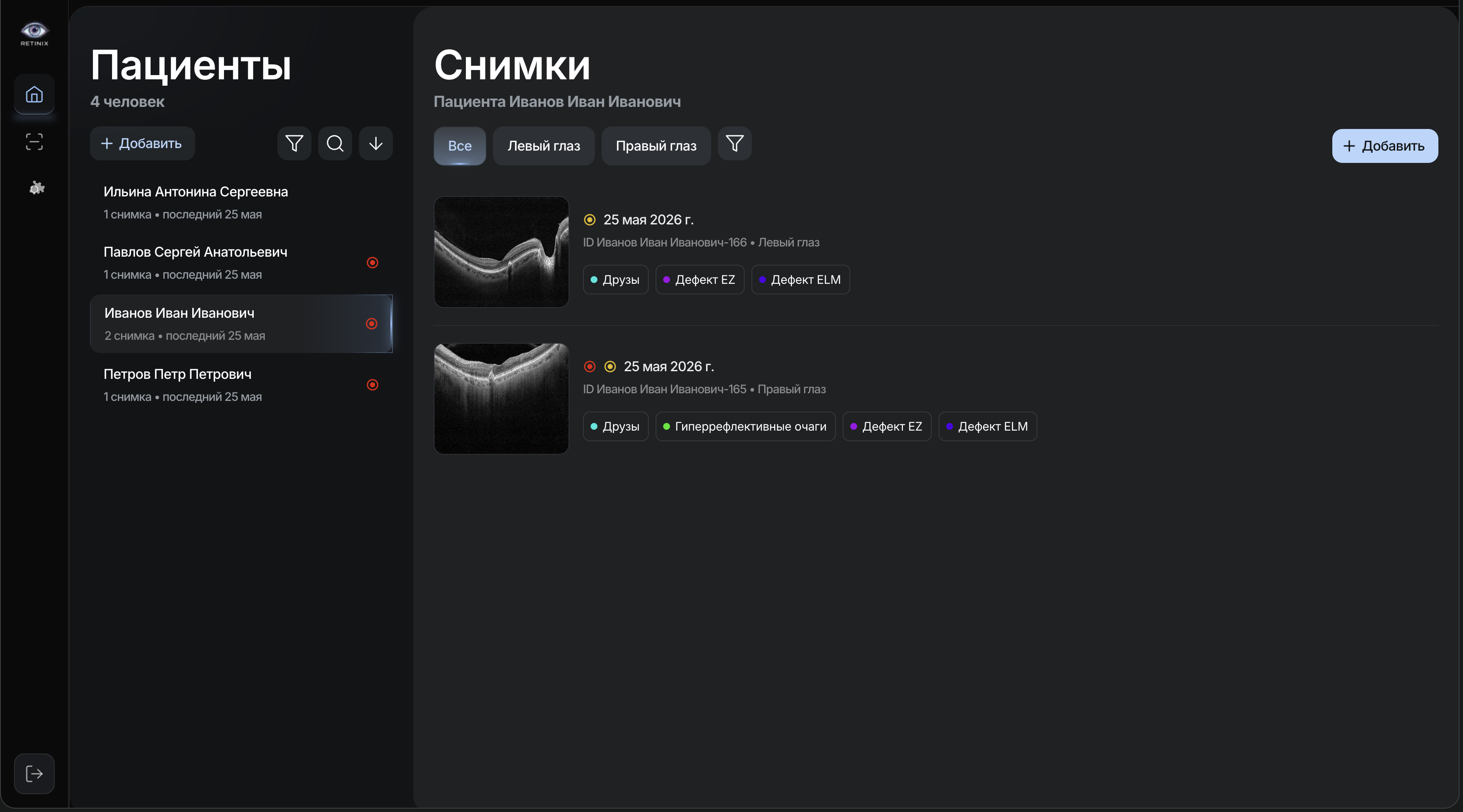 Retinix Interface